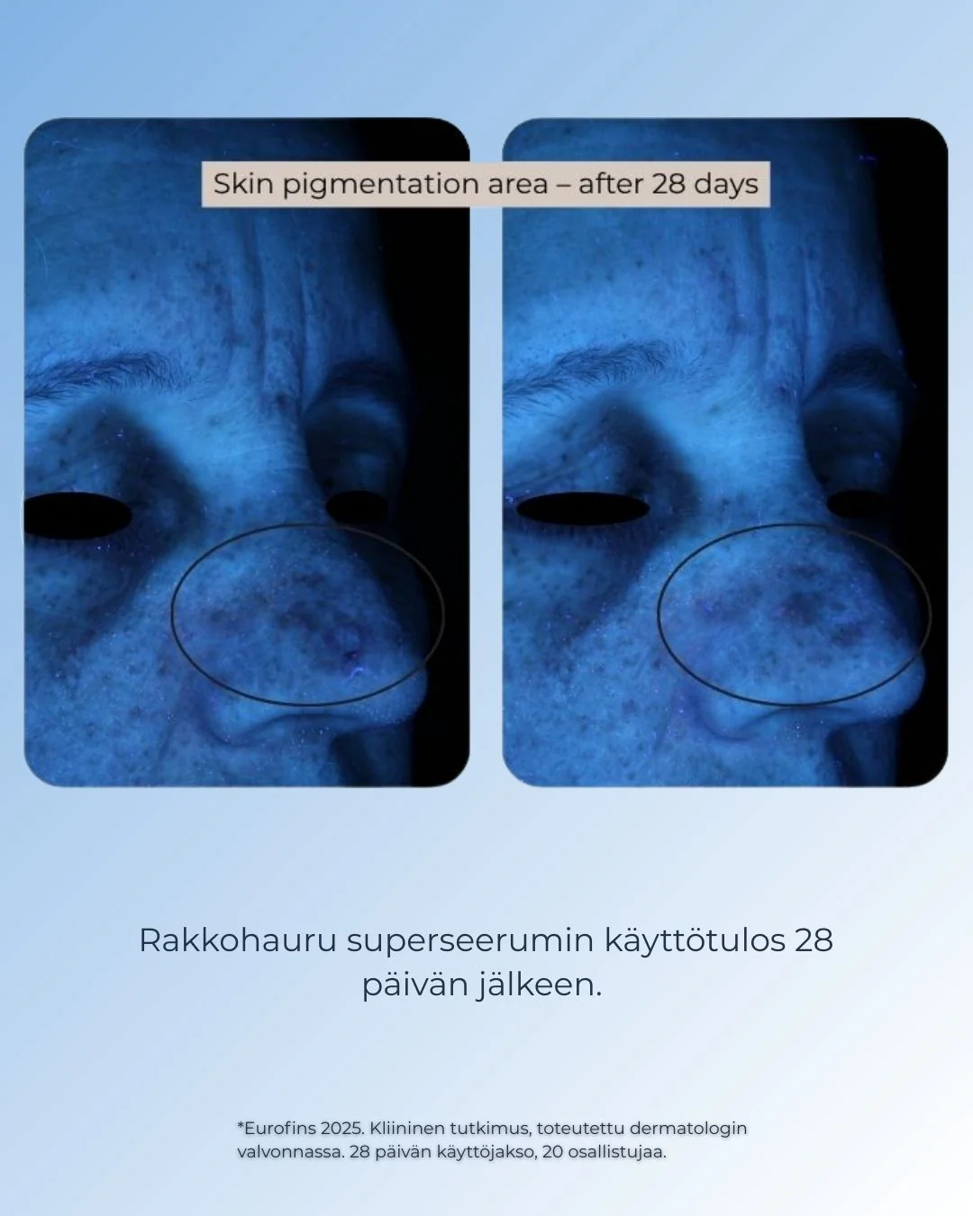 Tuotekuva 8