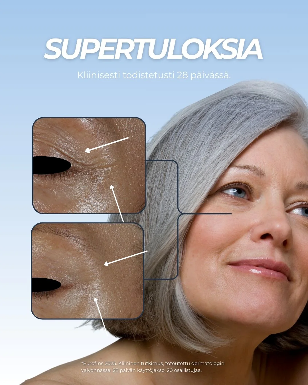 Pikkukuva 2