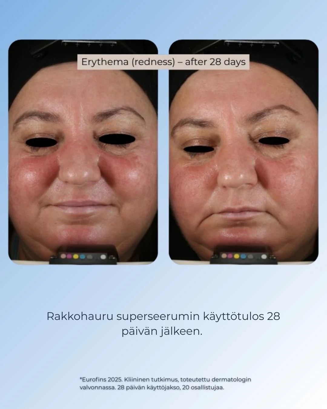 Tuotekuva 4