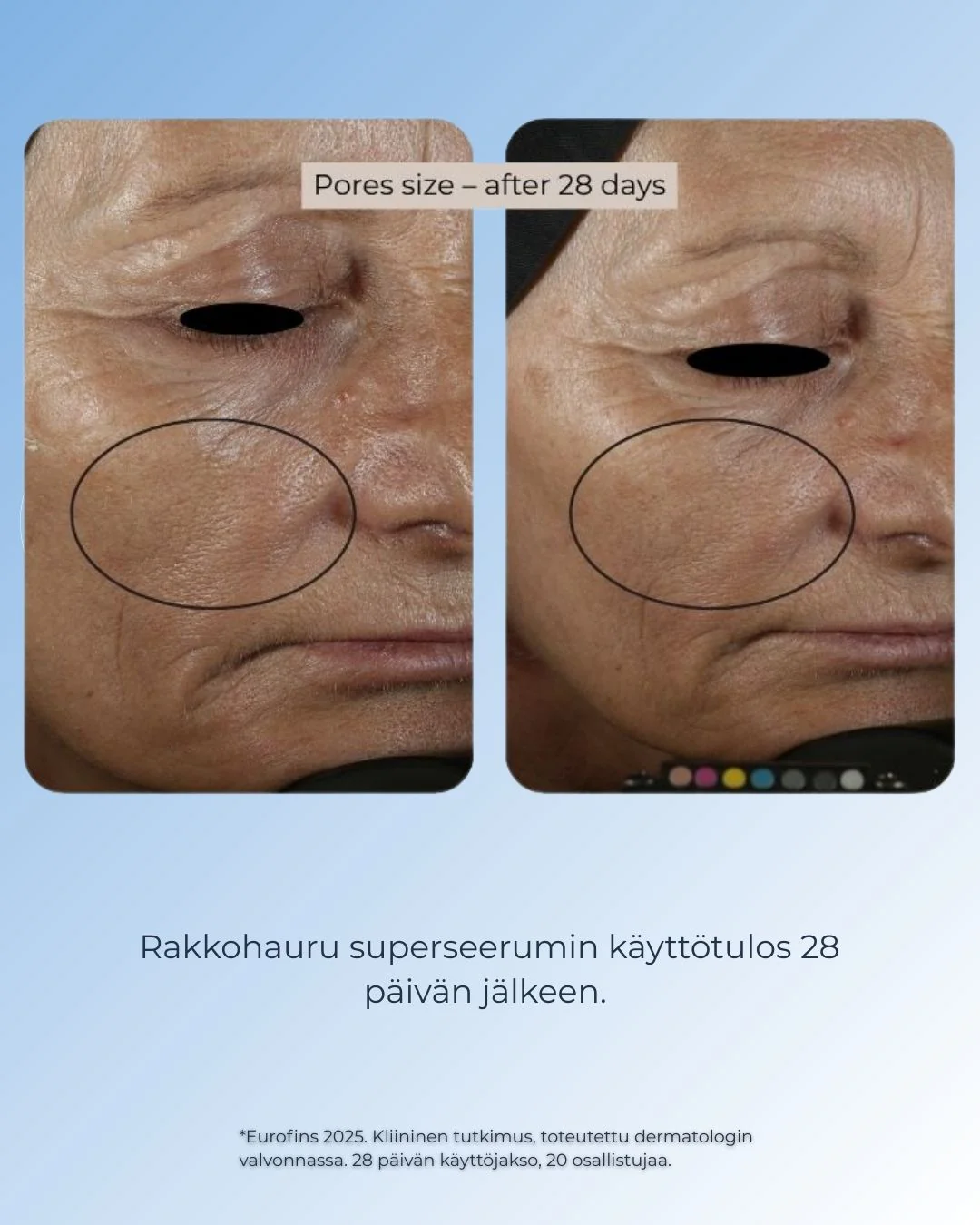 Tuotekuva 6