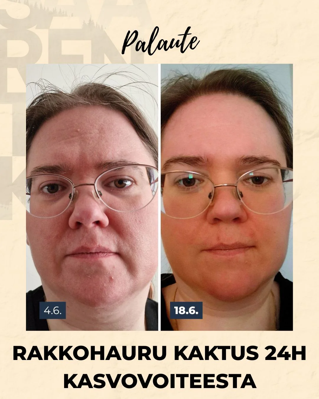 Tuotekuva 14