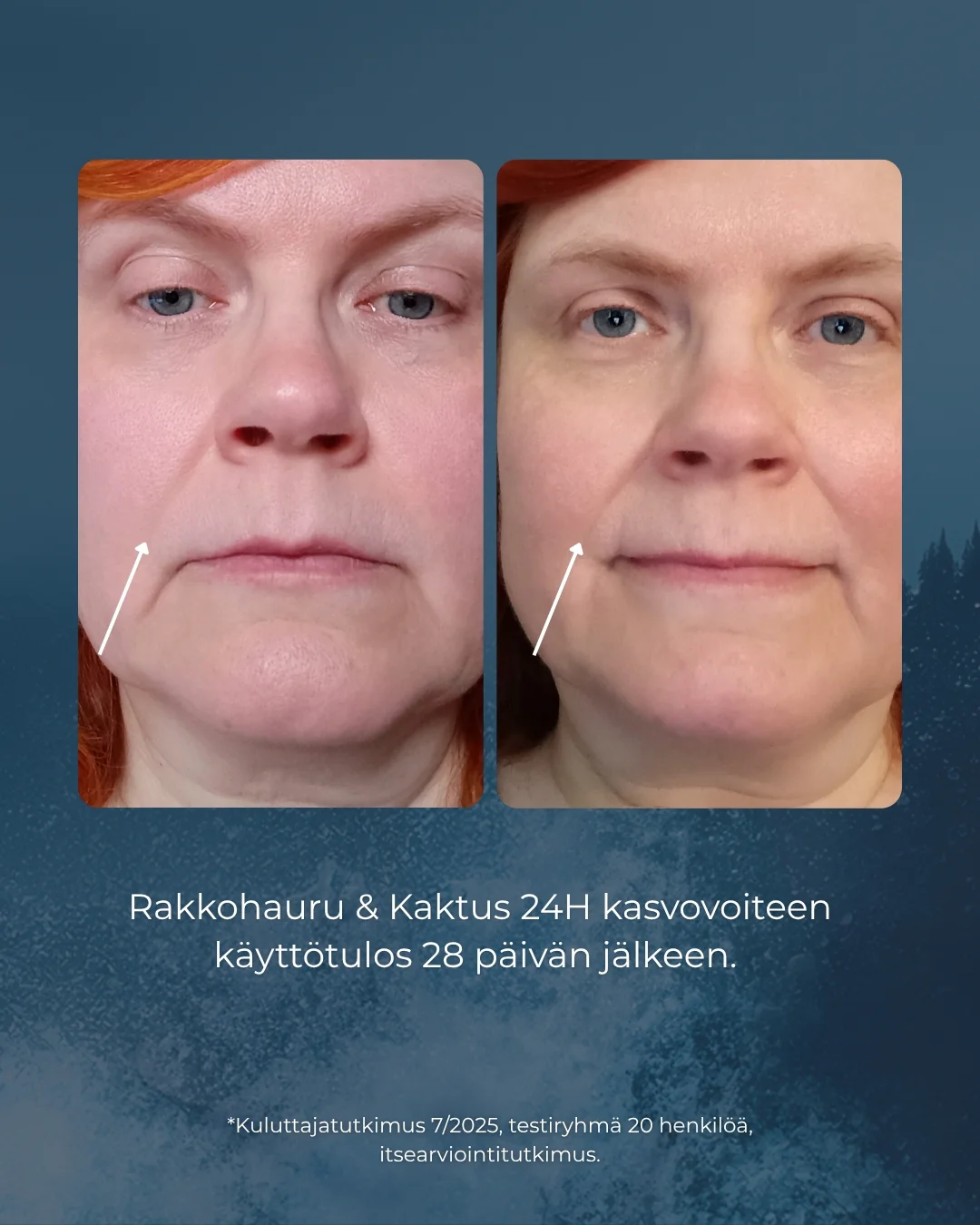 Tuotekuva 4