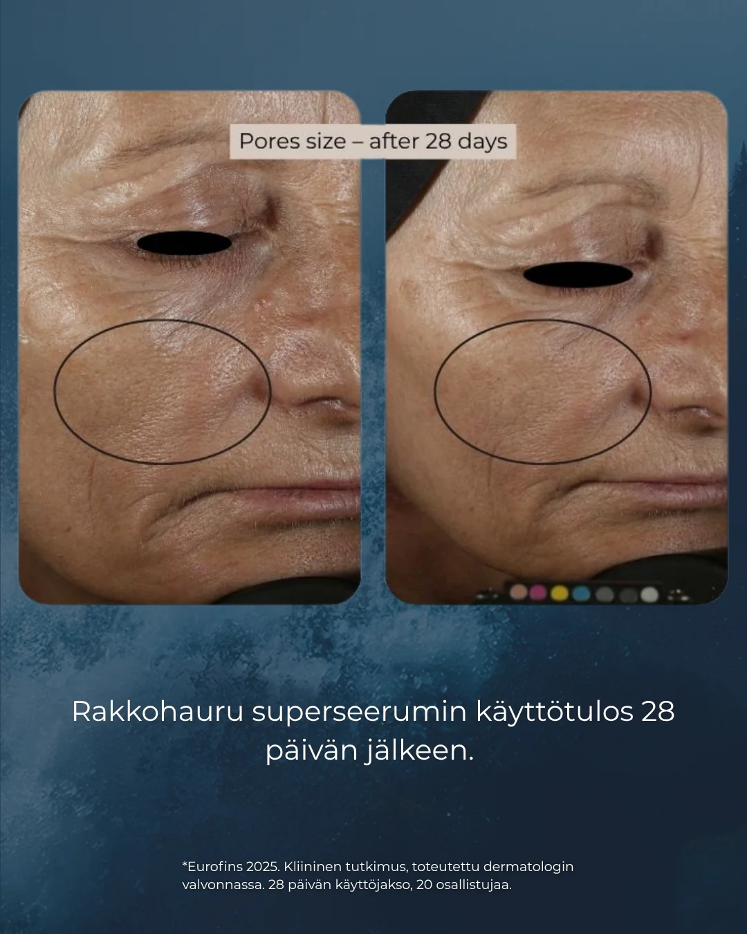 Tuotekuva 5