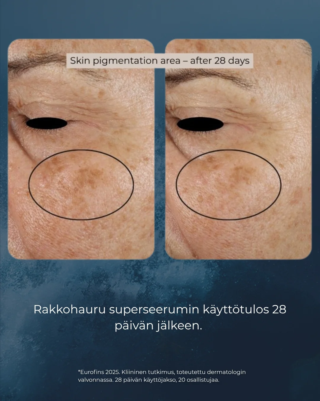Tuotekuva 6