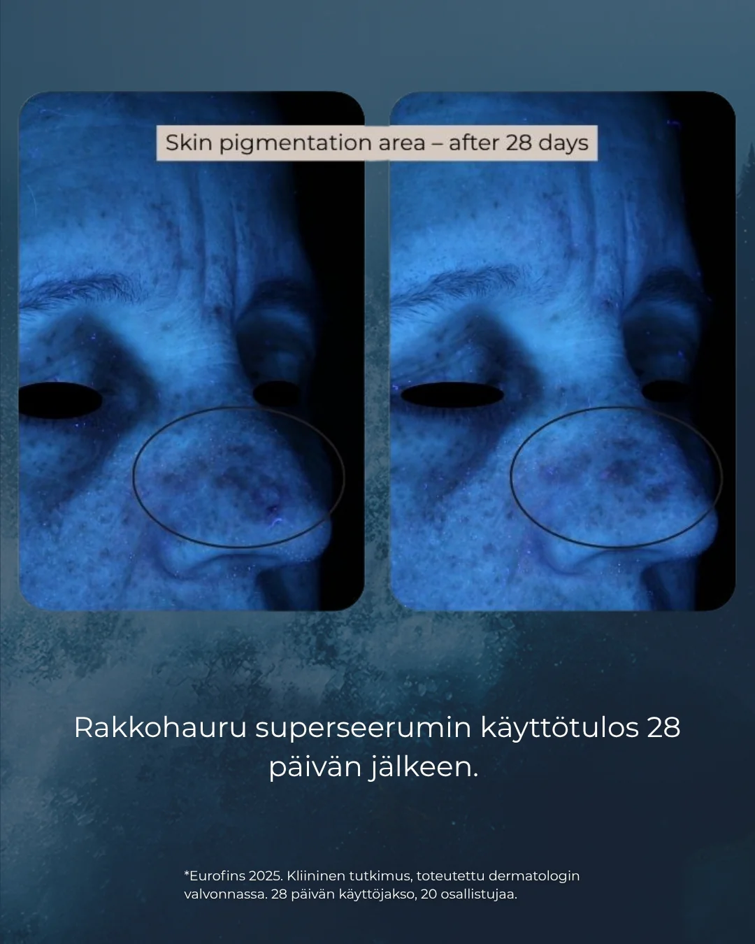 Tuotekuva 8
