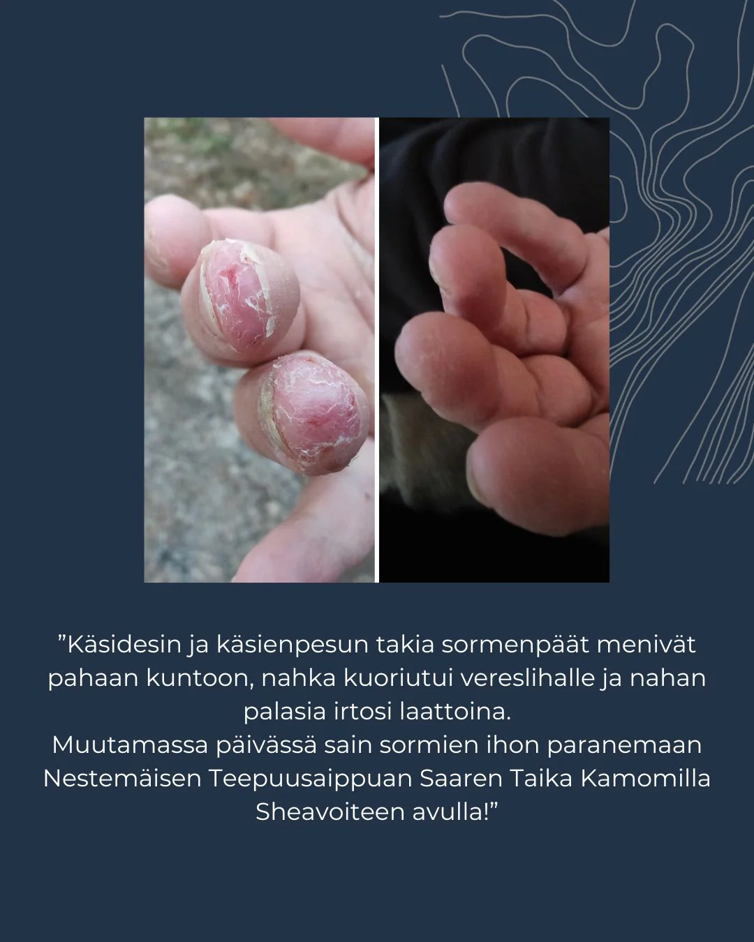 Tuotekuva 6