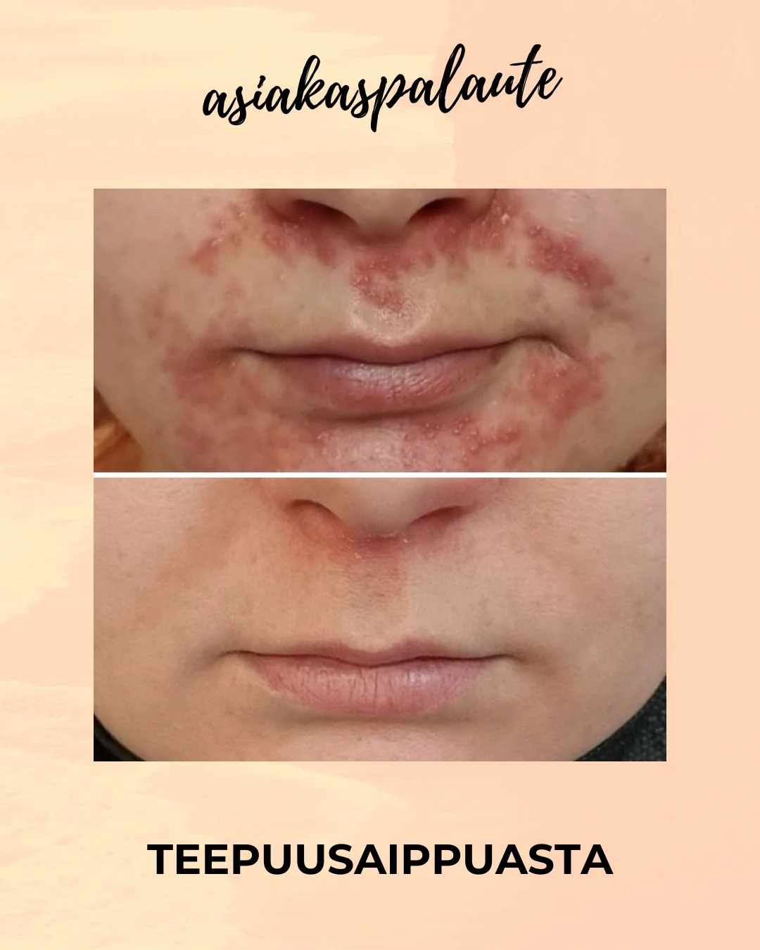 Tuotekuva 6
